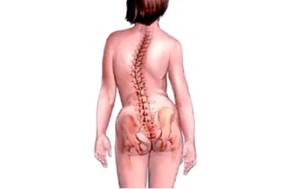 Causes of the Cervical Osteochondrosis