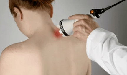 Treatment of cervical osteochondrosis with physiotherapy