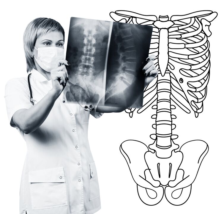 The radiography of the lumbar spine
