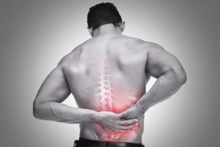 back pain in osteochondrosis