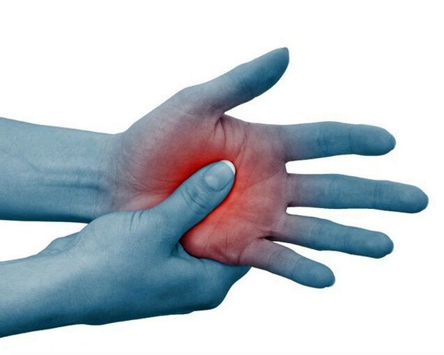 A typical symptom of rheumatoid arthritis is severe pain in the joints of the fingers, which decreases with exercise. 